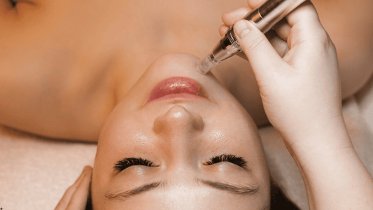Microneedling vs laser – vad är bäst?