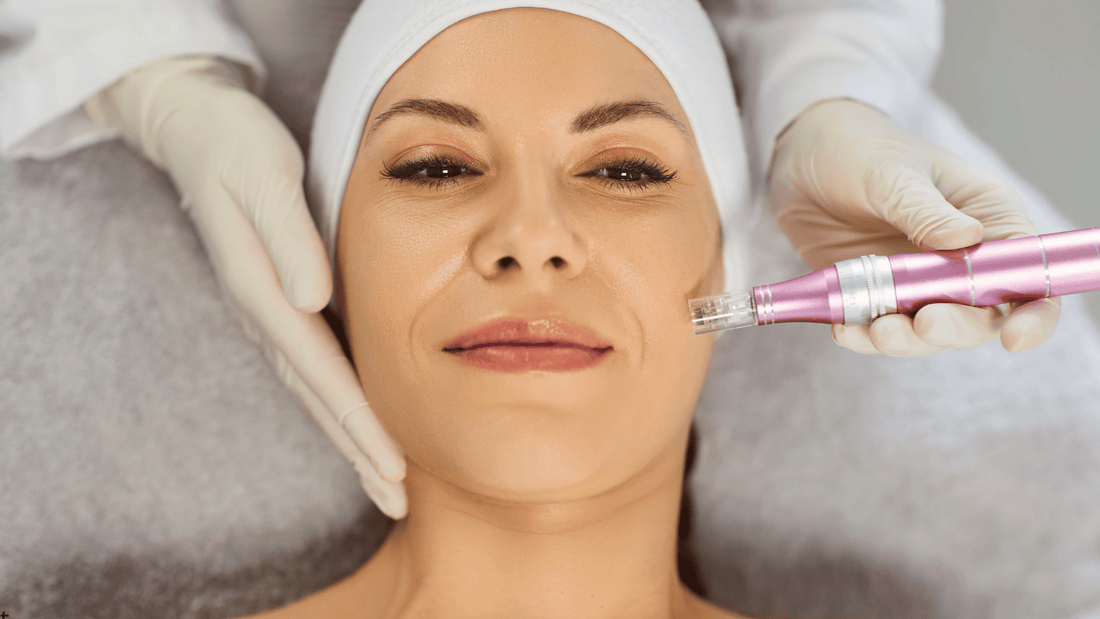 Ansiktsbehandling med microneedling utförd av hudterapeut, exempel på professionell behandling där microneedling inte ska göras vid infektion, inflammation eller aktiv hudsjukdom