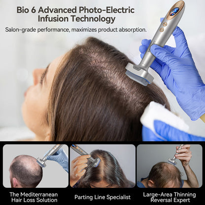 Bio Pen Bio 6 se utiliza en el tratamiento de la caída del cabello con tecnología avanzada de infusión fotoeléctrica, muestra aplicación profesional para estimular el crecimiento del cabello y mejorar la absorción de productos en áreas con poco cabello.