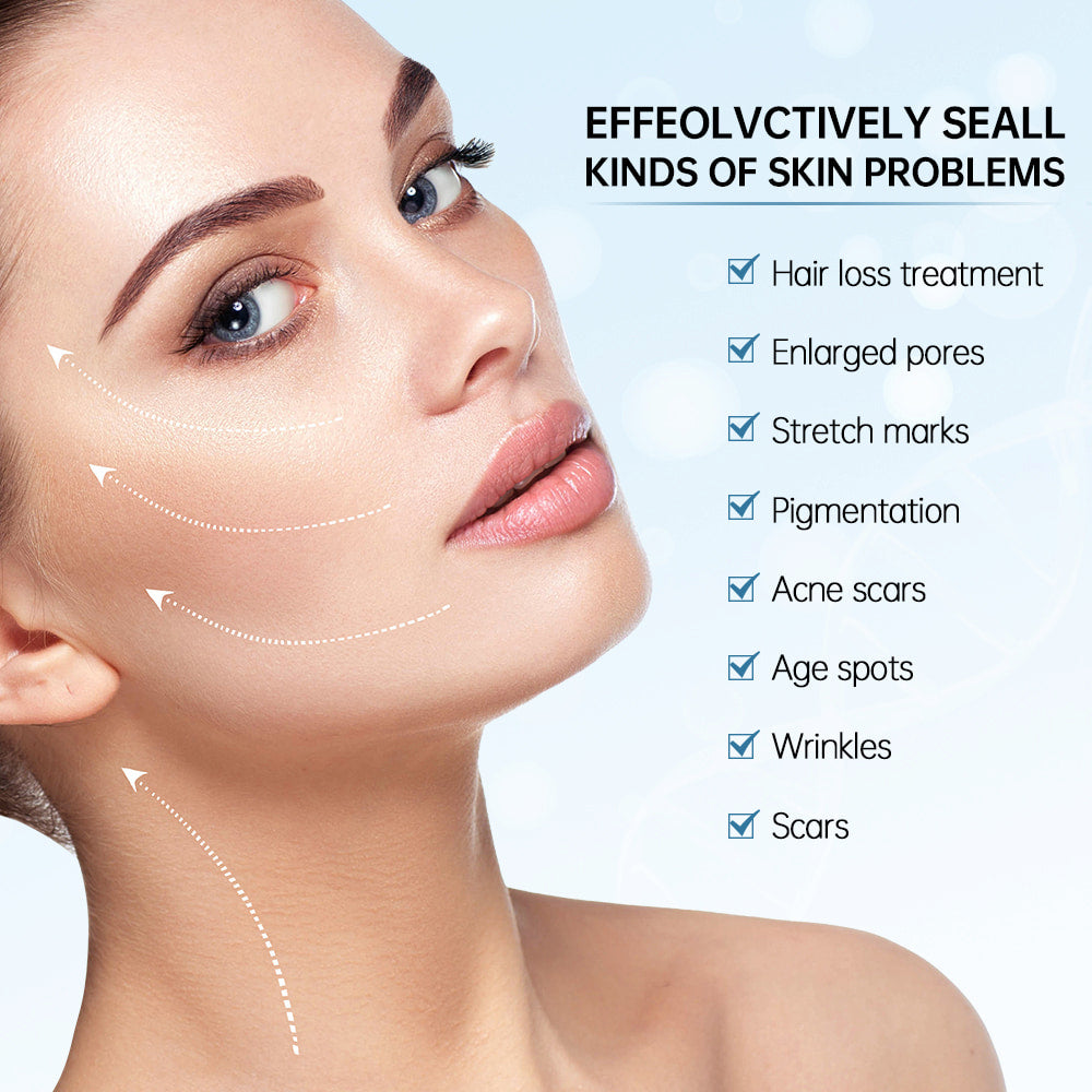 Mujer mostrando resultados de microneedling para el tratamiento de problemas de la piel como poros grandes, cicatrices, cicatrices de acné, manchas de pigmento, arrugas y líneas finas.