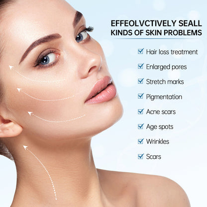 Mujer mostrando resultados de microneedling para el tratamiento de problemas de la piel como poros grandes, cicatrices, cicatrices de acné, manchas de pigmento, arrugas y líneas finas.